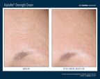 AlphaRet Overnight Cream 50 ml