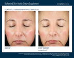 BioRewind Skin Health Dietary Supplement