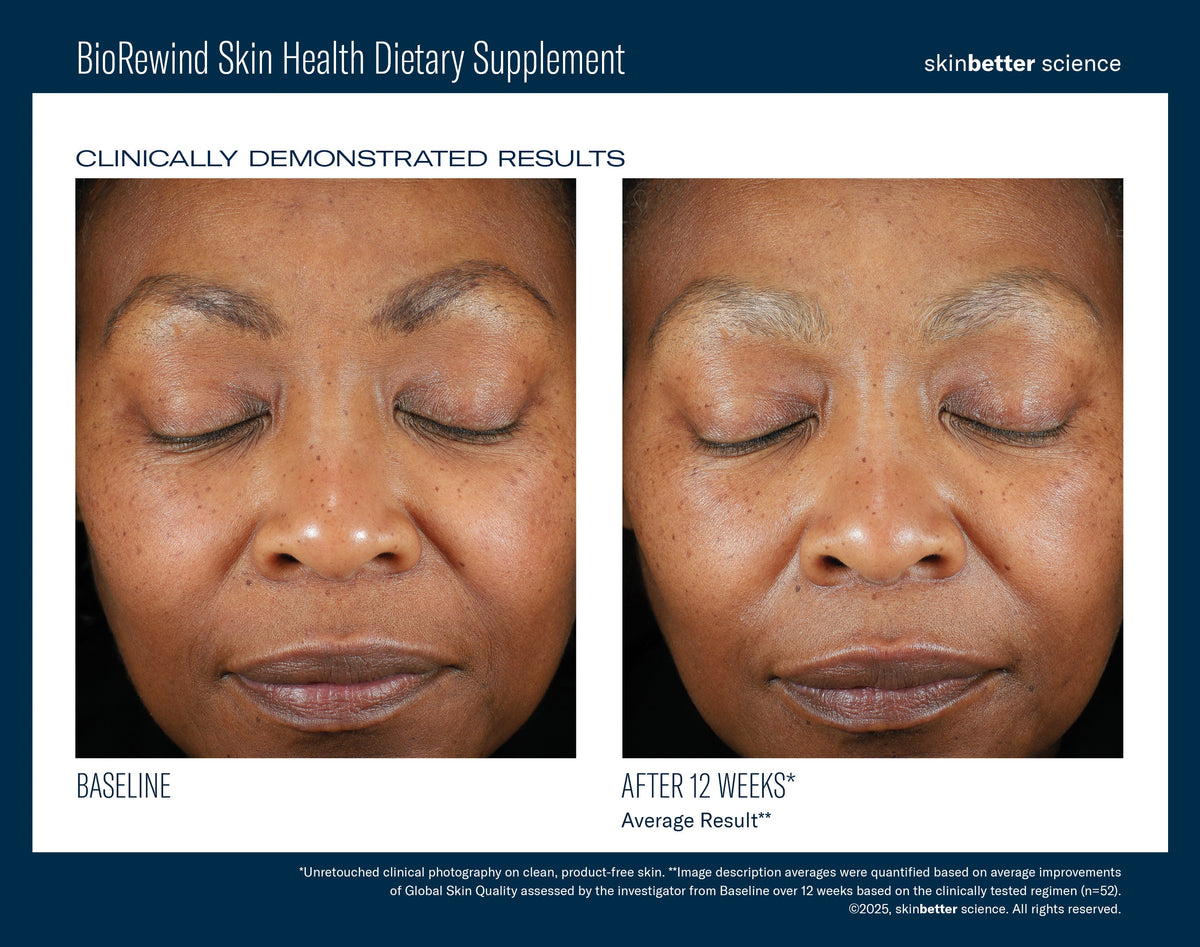 BioRewind Skin Health Dietary Supplement