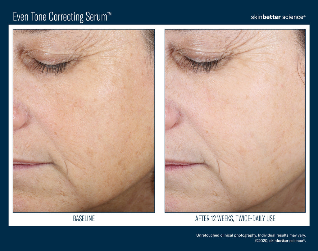 Even Tone Correcting Serum 50 ml