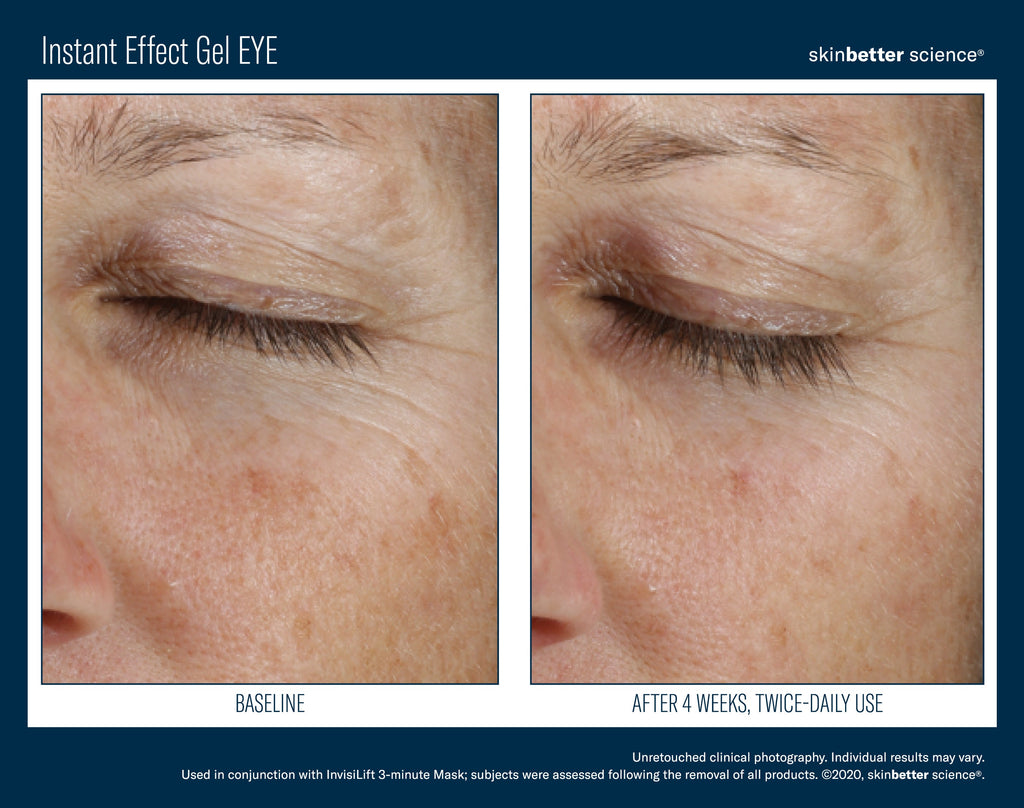 Instant Effect Gel EYE