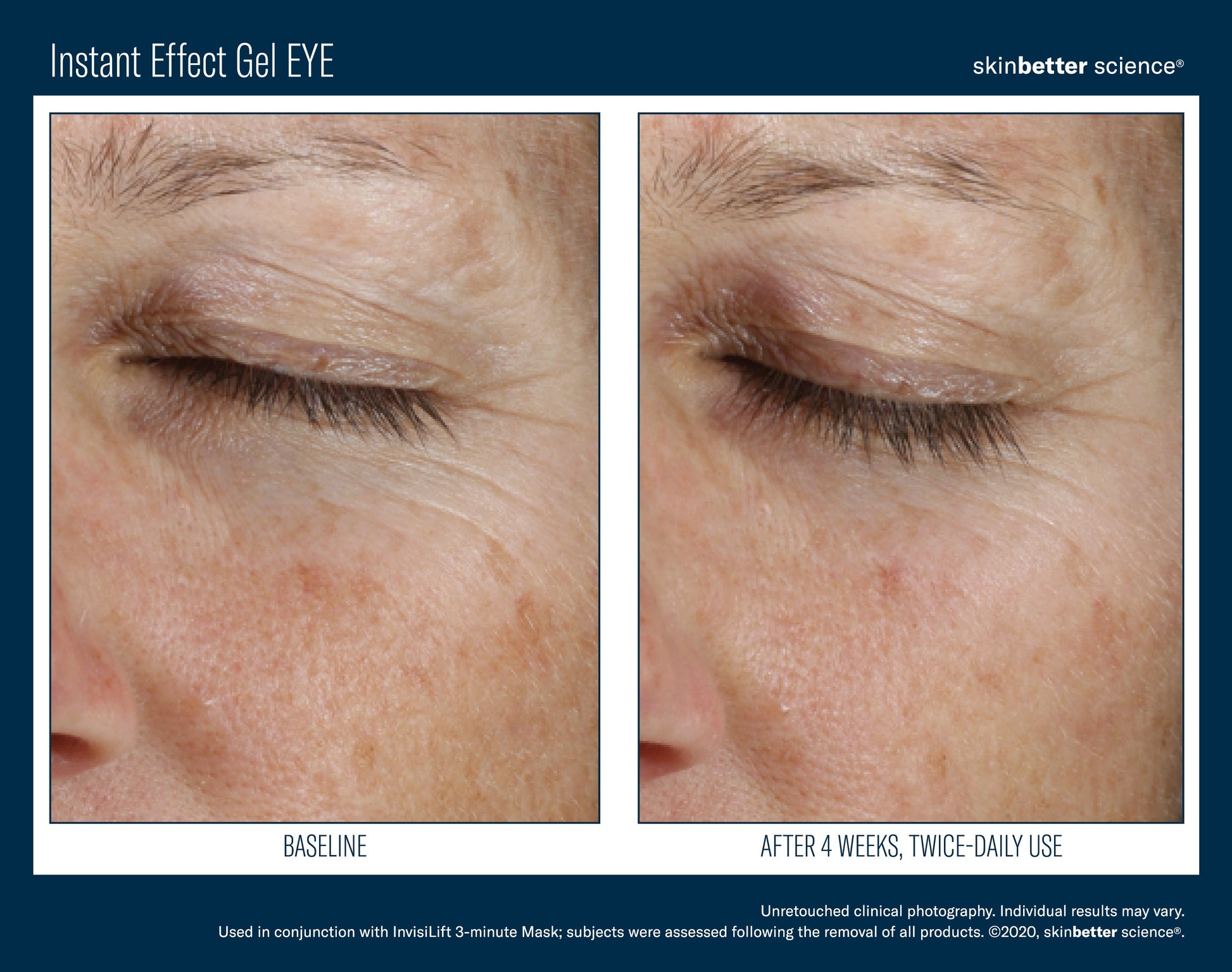 Instant Effect Gel EYE