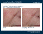 InterFuse Treatment Cream FACE & NECK 30 ml