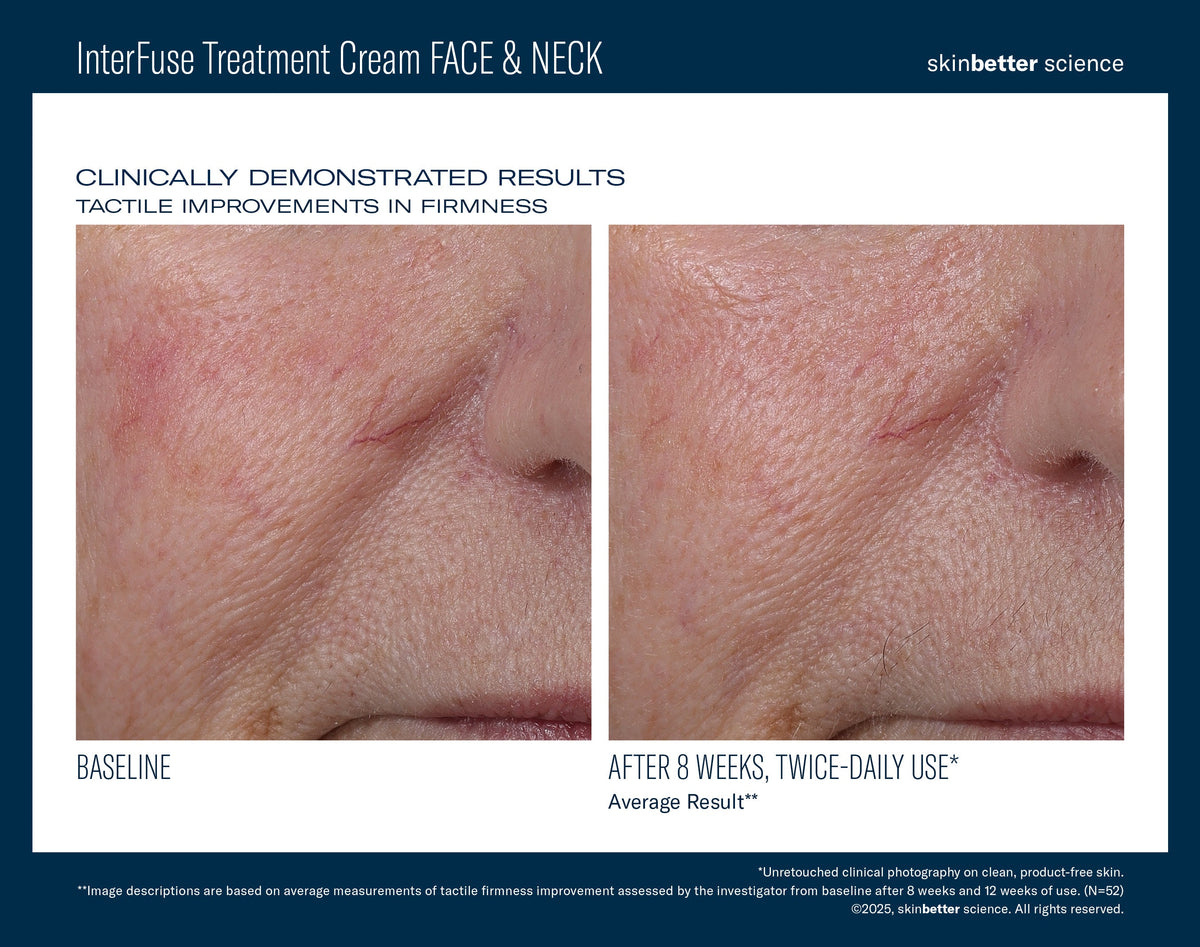 InterFuse Treatment Cream FACE & NECK 50 ml