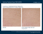 InterFuse Treatment Cream FACE & NECK 50 ml