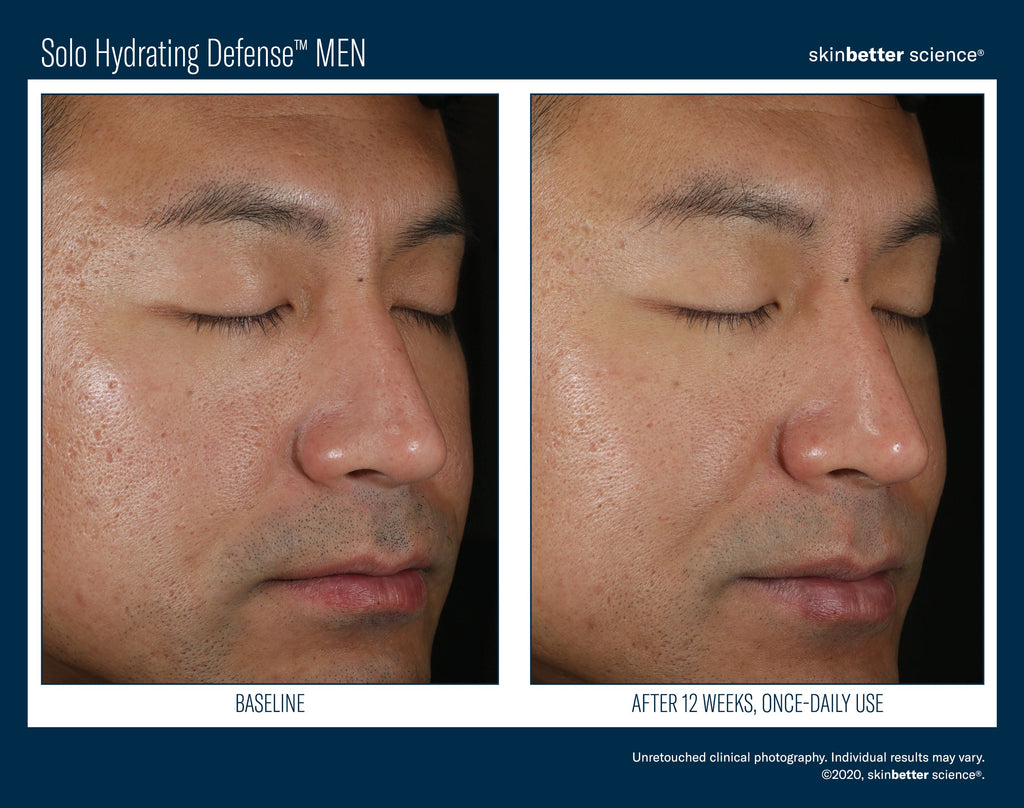 Solo Hydrating Defense MEN