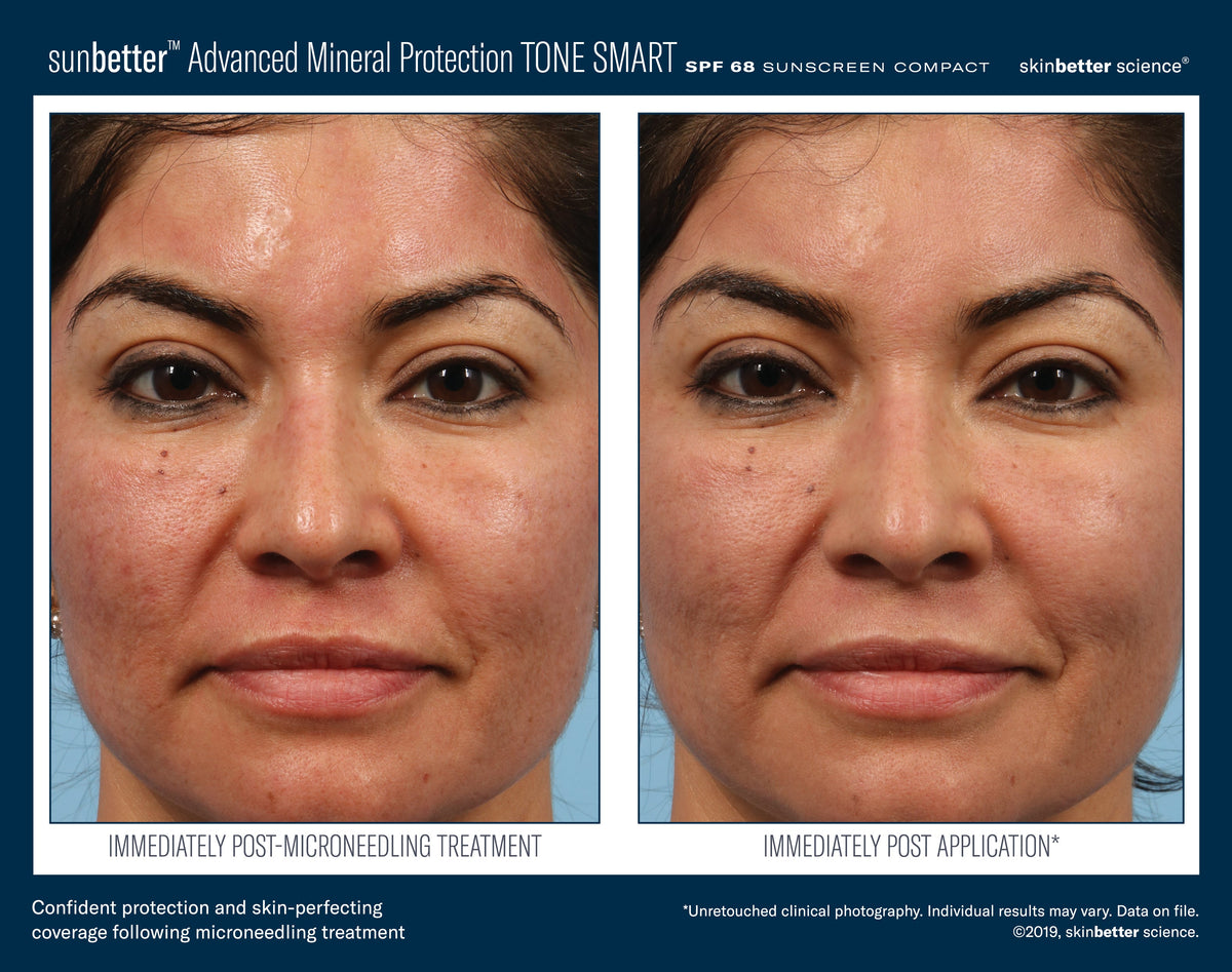 SunBetter TONE SMART SPF 68 Sunscreen Compact