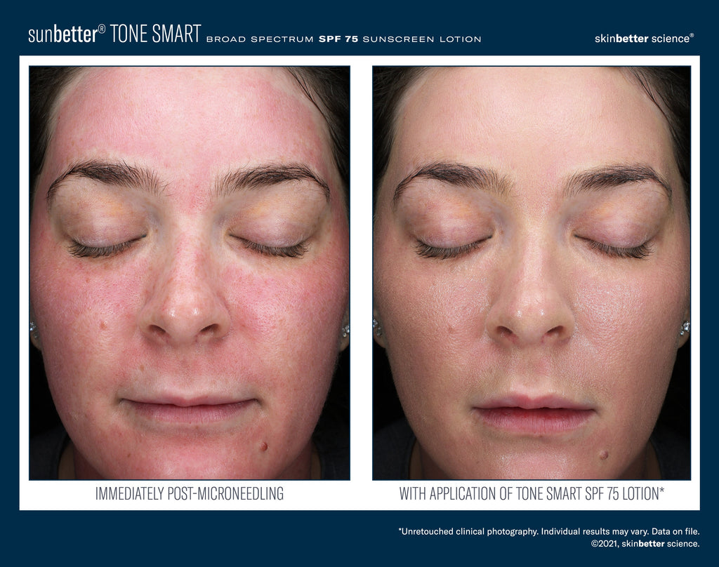SunBetter TONE SMART SPF 75 Sunscreen Lotion