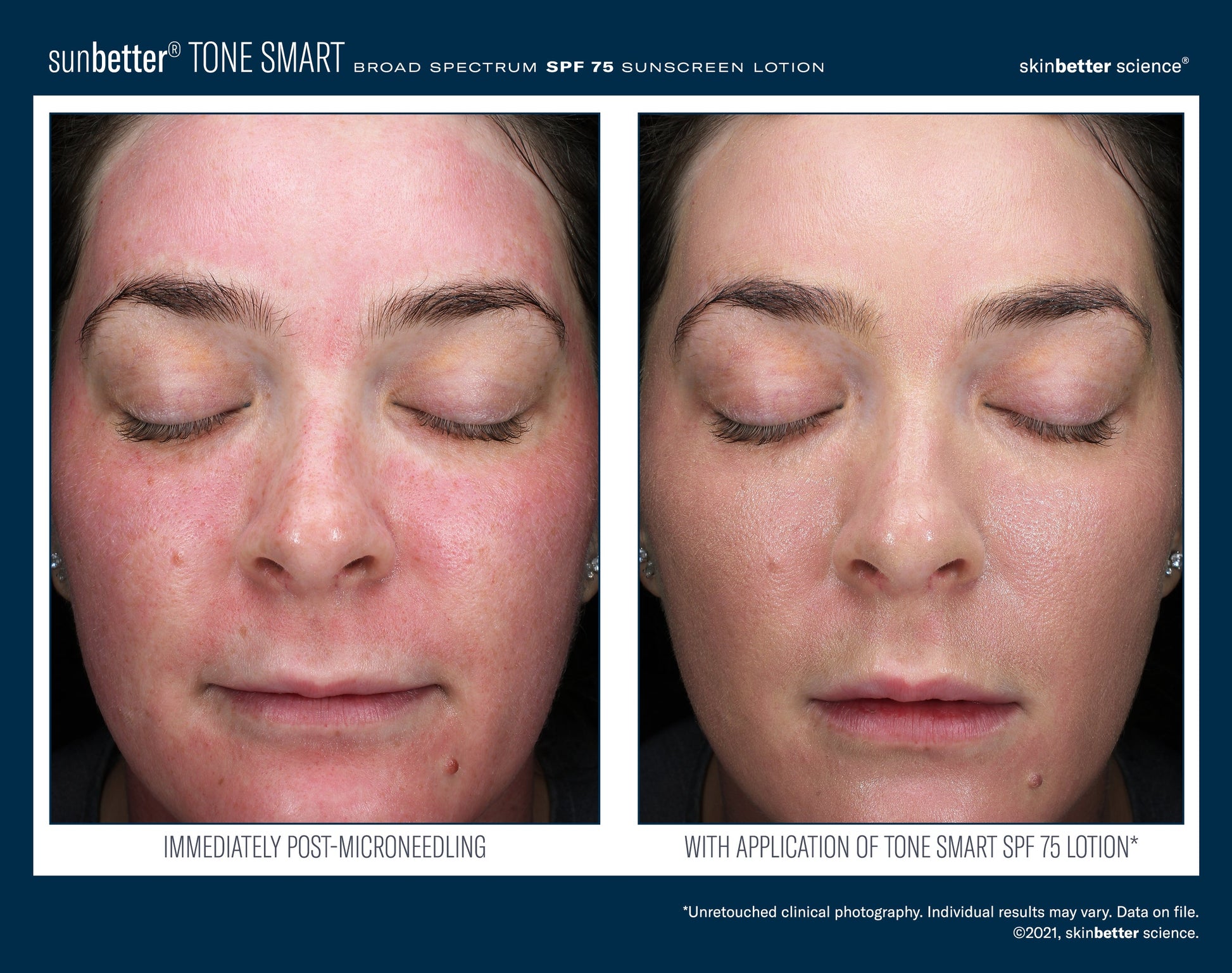 SunBetter TONE SMART SPF 75 Sunscreen Lotion