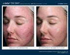 SunBetter TONE SMART SPF 75 Sunscreen Lotion