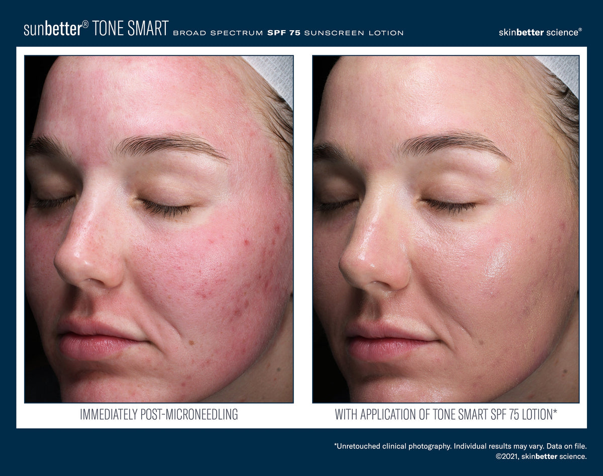 SunBetter TONE SMART SPF 75 Sunscreen Lotion
