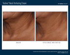 Techno Neck Perfecting Cream